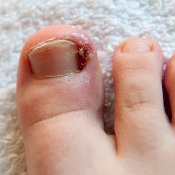 Toenail