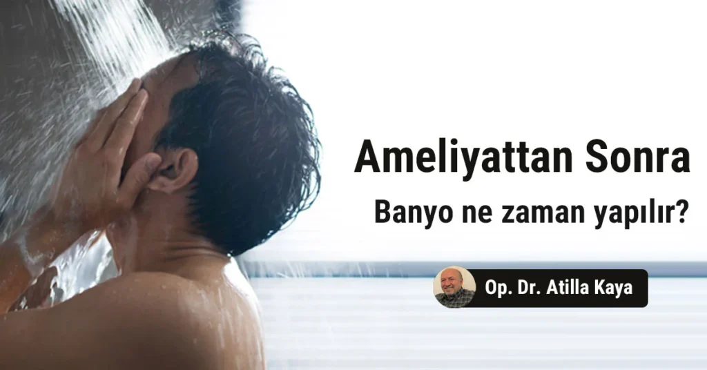 Ameliyattan sonra banyo ne zaman yapılır?