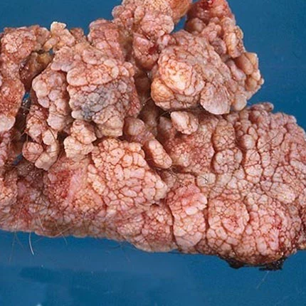 Makat siğili nasıl geçer